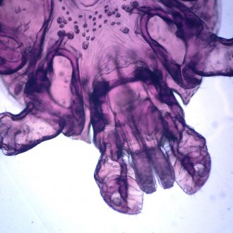 Dermacentor Variabilis, w.m., Microscope Slide