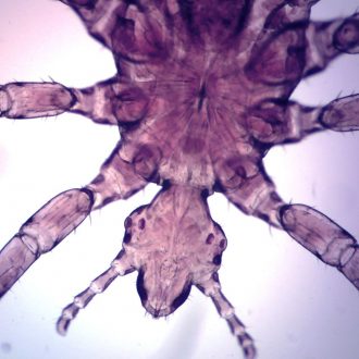 Pediculus Humanus, w.m., Microscope Slide
