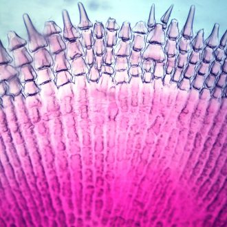 Scale, Ctenoid, w.m., Microscope Slide