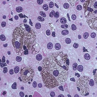 Amphiuma Liver, sec. 7 µm H&E Microscope Slide