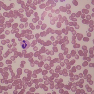Human Female Blood Film Slide, Smear