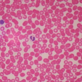 Human Male Blood Film Slide, Smear
