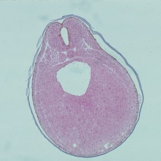 Frog Early Neural Tube, c.s Microscope Slide