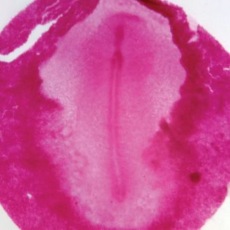 Chick 18-Hour Embryo Slide, w.m.
