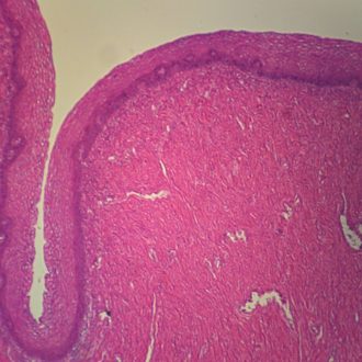 Human Stratified Squamous Epithelium, sec. 7 µm H&E Microscope Slide