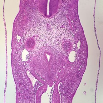 Mammal Mesenchyme, sec. 7 µ H&E Microscope Slide