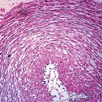 Mucous Tissue, cross section, Microscope Slide
