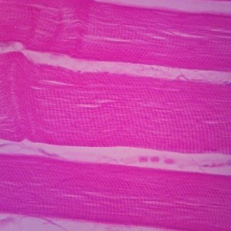 Adult Human Skeletal Muscle Slide, l.s., 7 µm, H&E