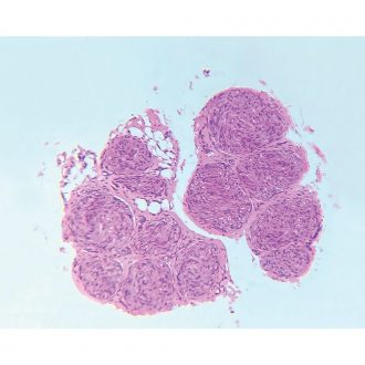 Nerve, cross section, Microscope Slide