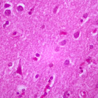 Human Cerebral Cortex, sec. 7 to 8 µm H&E Stain Microscope Slide