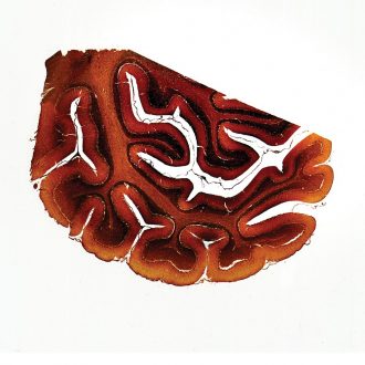 Mammal Cerebellum, sec. 7 µm silver stain Microscope Slide