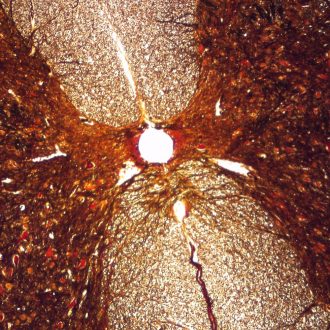 Mammal Spinal Cord, c.s. 7 µm silver stain Microscope Slide