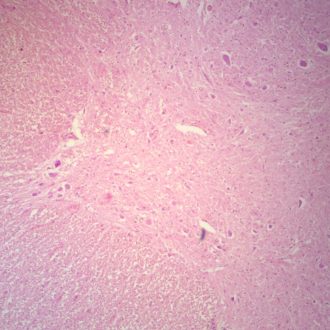 Human Spinal Cord, c.s. 7 µm H&E Microscope Slide