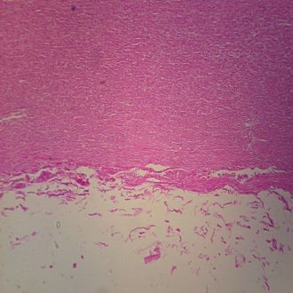 Human Aorta c.s. 7 µm H&E Microscope Slide