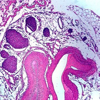 Artery, cross section, Microscope Slide