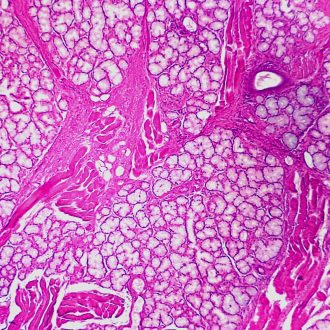 Tonsil, Lingual, Human, Sec. Microscope Slide