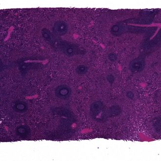 Human Spleen sec. 7 µm H&E stain Microscope Slide