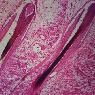 Human Scalp Slide, 7 µm, H&E