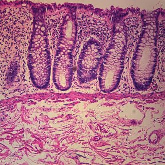 Human Colon Slide, c.s., 7 µm, H&E