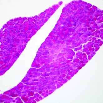 Human Pancreas, sec. 7 µm H&E Microscope Slide