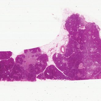 Human Pancreas, sec., Thin Microscope Slide,
