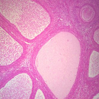 Mammal Ovary Follicles, sec. 7 µm, H&E Microscope Slide