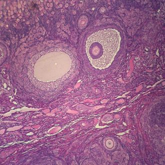 Mammal Graafian Follicles, sec. 7 µm H&E Microscope Slide