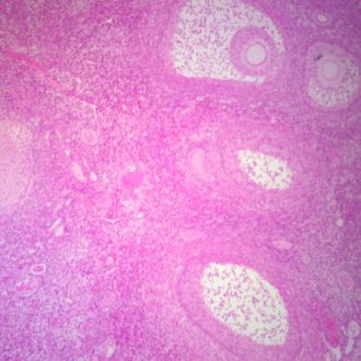 Mammal Ovary Slide, thin sec., H&E