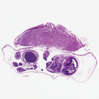 Uterus, Pregnant, Microscope Slide