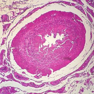 Human Ductus Deferens, c.s. 7 µm, H&E Microscope Slide