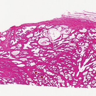 Human Prostate Gland - Older, sec. 7 µm, H&E Microscope Slide