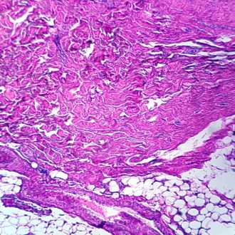 Scar, Microscope Slide