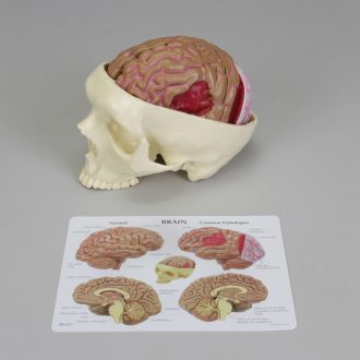 GPI Anatomicals® Human Brain Model in Skull with Pathologies