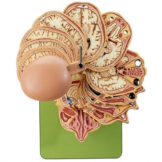 Somso® Horizontally Sectioned Model of the Human Head