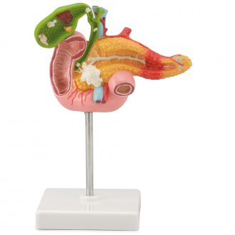 Altay® Pathology of the Human Pancreas, Duodenum, and Gallbladder Model