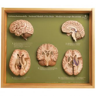 Somso® 5 Section Models of the Human Brain