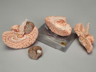 Somso® Human Brain Model, 4 Parts