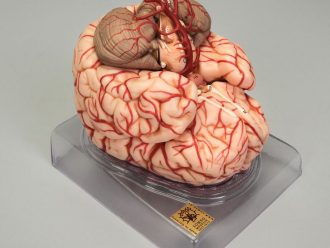 Somso Human Brain with Arteries Model