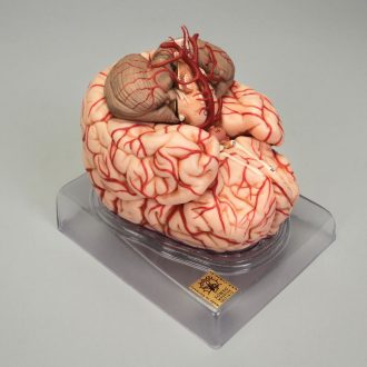Somso Human Brain with Arteries Model