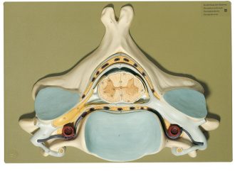 Somso® Human Spinal Cord Section Model