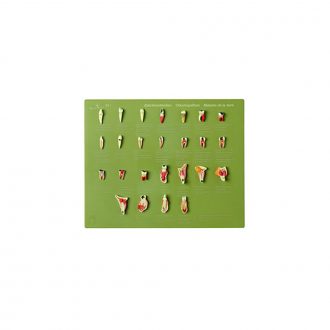 Somso® Case of Teeth: Odontopathies Model