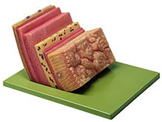 Somso® Human Stomach Wall Model