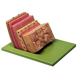 Somso® Human Stomach Wall Model