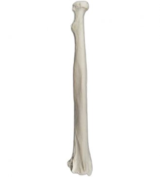 Human Bone Model, Right Radius