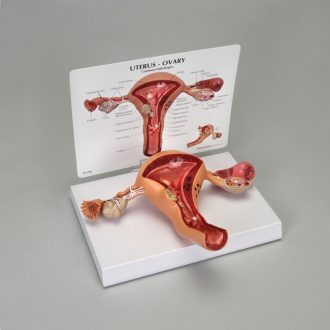 GPI Anatomicals® Human Uterus and Ovary Pathology Model