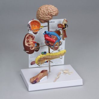 GPI Anatomicals® Type 2 Diabetes Model