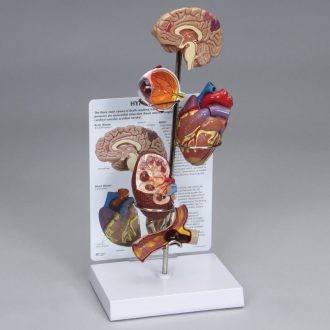 GPI Anatomicals® Hypertension Model