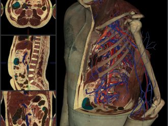 VH Dissector Virtual Anatomy Lab, Student Online Access