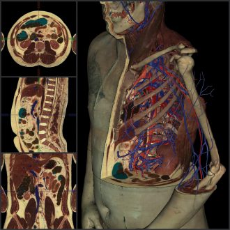 VH Dissector Virtual Anatomy Lab, Lifetime Teacher Online License